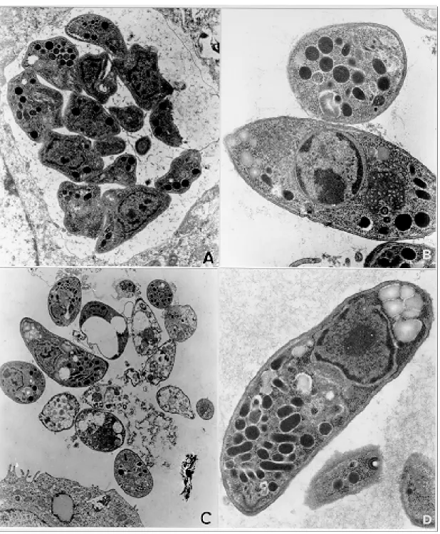 Fig. 3: TG180 sarcoma murine cells after in vitro infection of by RH strain of Toxoplasma gondii