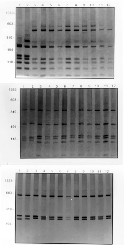 Fig. 7: (AluI) silver stained polycrylamide gel (6% or 8%) showing the restriction fragment length polymorphism profiles obtained following digestion of rDNA internal transcribed spacer  with HpaII (A), HaeIII (B), AluI (C) amplified from DNA extracted fro