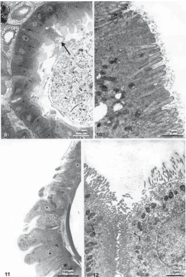 Fig. 9: columnar cells of the midgut of a larva after treatment of 1 h with 4 mg/l of Bacillus thuringiensis serovar israelensis  (Bti) suspension