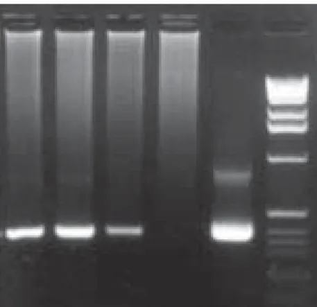 Fig. 2: determination of the detection sensitivity of Mycobacte- Mycobacte-rium tuberculosis complex DNA