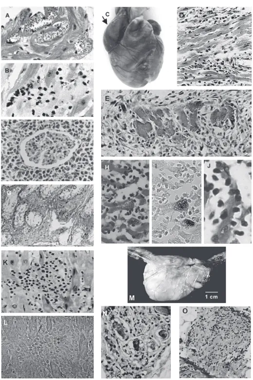 Fig. 5: comparative pathology of Chagas disease. Profiles of Trypanosoma cruzi infections in mouse
