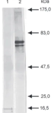 Fig. 1: Western blot of purified initial bodies from a Brazilian iso- iso-late (Pernambuco - Zona da Mata) of Anaplasma marginale and monoclonal antibodies (MoAb) ANAF16C1 (anti-MSP5) and ANA22B1 (anti-MSP1a)