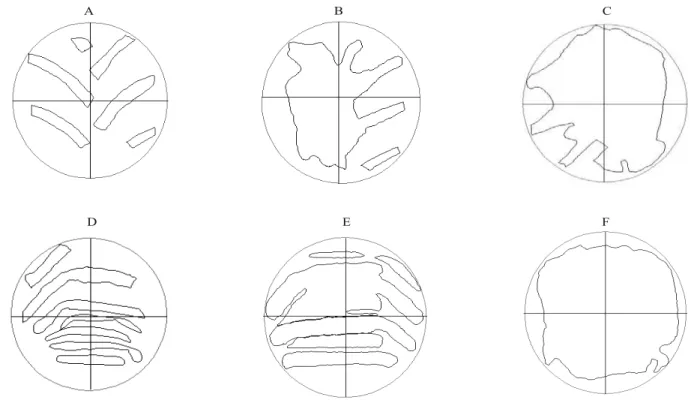Figura 3. Áreas de contato dos rodados do trator (A, B e C) e do transbordo (D, E e F), obtidas em superfície rígida (A e D)  e no solo sem (B e E) e com palha (C e F)