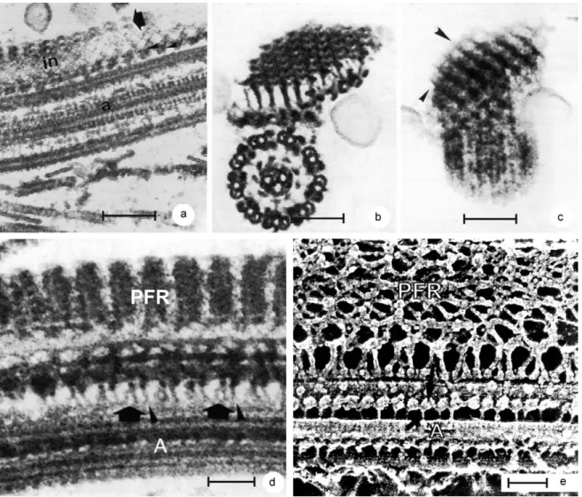 Fig. 8: different view of the flagellum of trypanosomatids as seen in longitudinal (a, d) and transversal (b, c) views of thin sections and replicas  of quick-frozen, freeze-fractured, deep-etched and rotary repilicated samples (e)