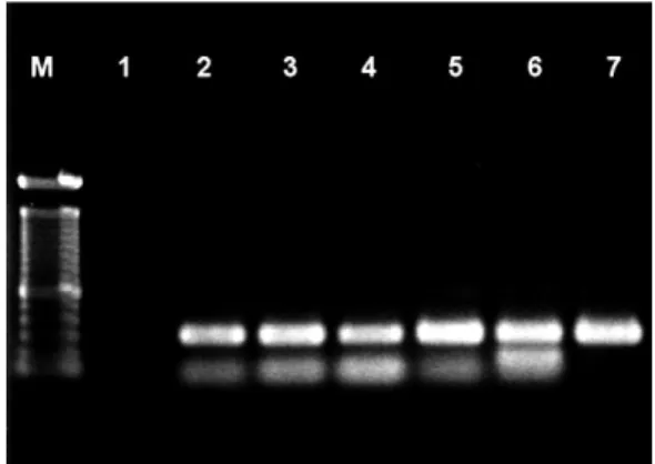 Fig. 5: PCR amplifications of Archaea (primers 1100/1400) in tissues  samples of chagasic patients