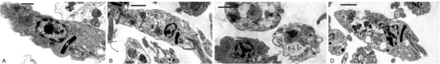 Fig. 4: transmission electron microscopy of epimastigotes from the supernatant (A, C) or adhered to the flask walls (B, D) from cultures kept in  triatomine artificial urine (TAU)3AAG medium for 24 h