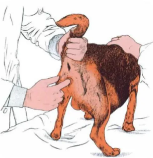 Figura 4 – Palpação do saco amniótico  que pode mascarar a abordagem ao feto  (Adaptado de: Jackson, 2004)