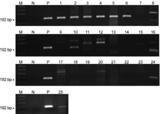 Fig.  5:  ethidium  bromide  staining  patterns  of  the  polymerase  chain  reaction (PCR) products on a 1.5% agarose gel
