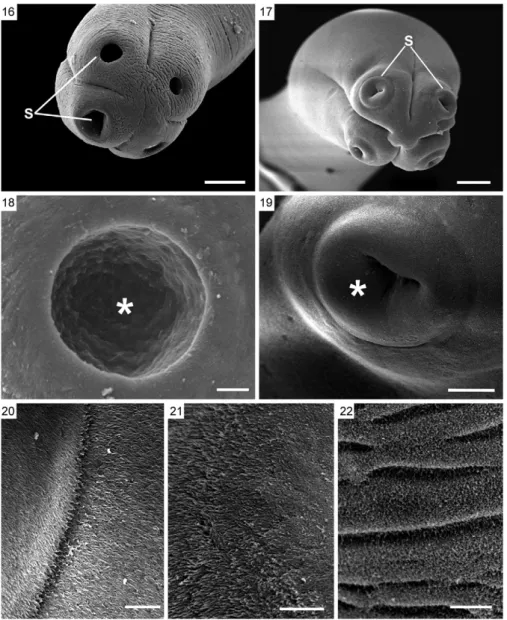 Figs 16-22: scanning electron microscopy of Lanfrediella amphicirrus gen. nov. sp. nov