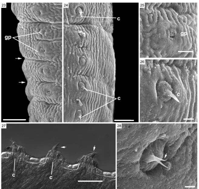 Figs 23-28: scanning electron microscopy of mature segments and differential interference contrast (DIC) of mature segments of Lanfrediella  amphicirrus gen