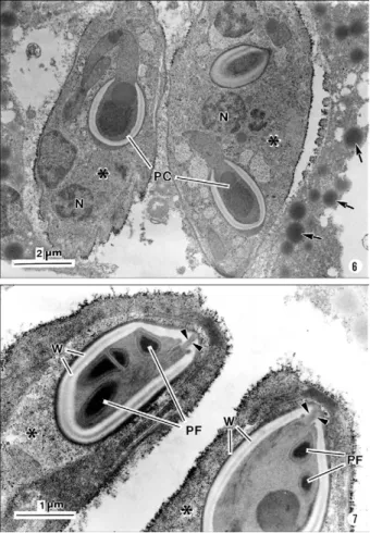 Figs  8-11:  ultrastructural  aspects  of  different  sections  of  the  polar  capsules (PC) and polar filaments (PF) obtained at different levels of  Myxidium volitans sp