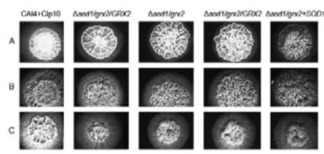 Fig. 2: hyphae formation on solid media. A: Spider medium; B: yeast  extract-peptone-dextrose + 10% serum; C: GlcNac