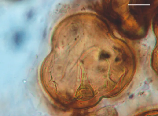 Fig. 4: egg of Viscachataenia quadrata (Cestoda: Anoplocephalidae). 