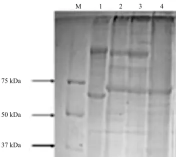 Figura 1.  Reação de amplificação por PCR dos genes cry1  e cry2 com tamanhos esperados de 500 pb