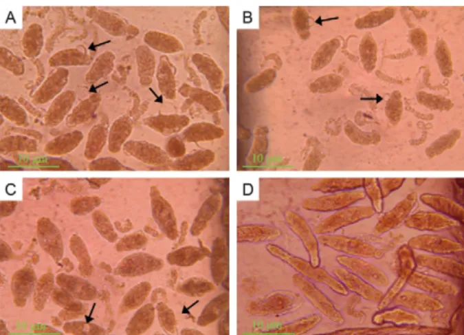 Fig. 3: micrographic images of schistosomula cultured in 96 h: dead  schistosomula showed an increased opacity and obvious lesions in the  tegumental outer membrane