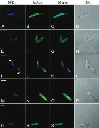 Fig. 3: actin localisation in Trypanosoma cruzi by using the T. cruzi  actin  gene  (TcActin)  antibody  (actin  detection  with  TcActin  mouse  polyclonal  antibody  plus  Alexa  Fluor  488-conjugated  rabbit   anti-mouse immunoglobulin G)