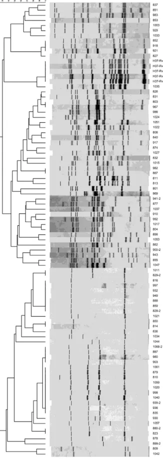 Fig.  1:  restriction  fragment  length  polymorphism  (RFLP)-IS6110  diagram and dendrogram