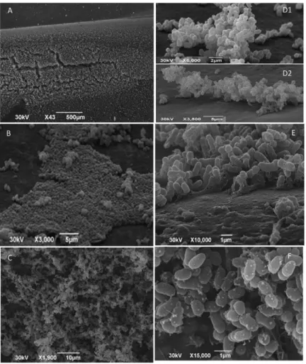 Fig.  3:  scanning  electron  micrographs  illustrating  biofilm  formation  on  polyurethane  catheter  surfaces  after  24  h  incubation  with  different  Corynebacterium striatum strains