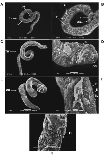 Fig. 6: scanning electron microscopy (SEM) of Schistosoma mansoni adult male worms exposed to different concentrations of primaquine (A-G)  for 24 h showing: (A) convoluting (CV) of the adult male worm body with destruction of tubercles (T) at the concentr