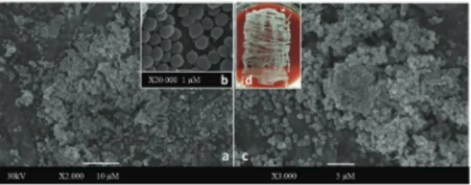 Fig. 1: biofilm formation on polyurethane catheter surfaces by oxa- oxa-cillin-resistant  Staphylococcus haemolyticus (ORSH) isolated from  fomites, verified by (A-C) scanning electron microscopy (SEM)  as-says and the roll plate Maki technique (D)