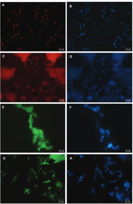 Fig. 2: Paracoccidioides spp. yeast cells hybridisation by FISH and TSA-FISH techniques