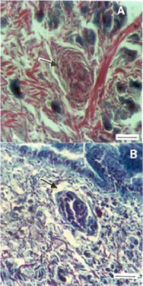 Fig. 5: cephalopodal region of Biomphalaria glabrata infected with Schistosoma mansoni