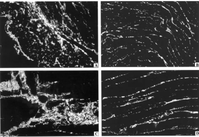 Fig. 3: sections of myocardium and skeletal muscle stained with the Picro-Sirius method  and examined under polarized light, showing positive bi-refringence of collagen deposits