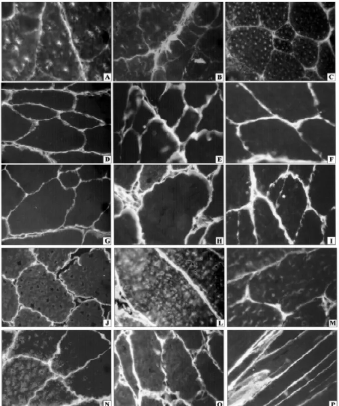 Fig. 4: immunotyping of the interstitial matrix components in skeletal muscle sections