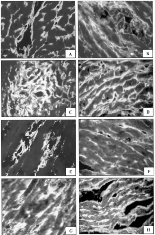 Fig. 5: myocardium, immunotyping of the interstitial matrix components. Type III collagen  - A: early phase of infection (30th day):