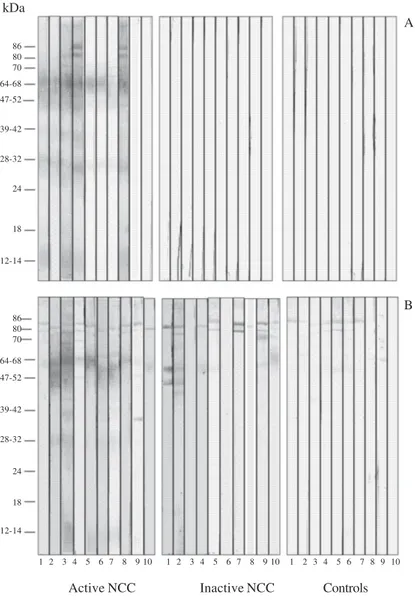 Fig. 1: western blot for the detection of IgG antibodies to Taenia solium metacestodes in cerebrospinal fluid (A) and serum (B) paired samples from patients with active neurocysticercosis (NCC) (n = 10), inactive NCC (n = 10), and 10 controls (with other n