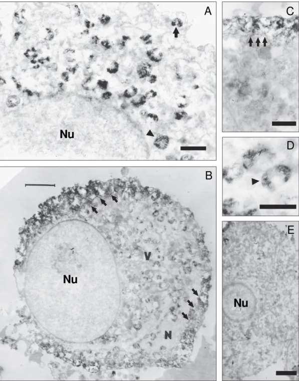 Fig. 2: electron micrographs of cultured sensory neurons. A: infected neuron 36 h pi. Many viral inclusions (arrow and arrowhead) were detected by using immunoperoxidase inside the cytoplasm near the nucleus (Nu)