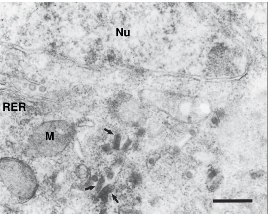 Fig. 3: electron micrograph of a cortex neuron from an infected mouse which was inoculated with infected sensory neuron cells lysate