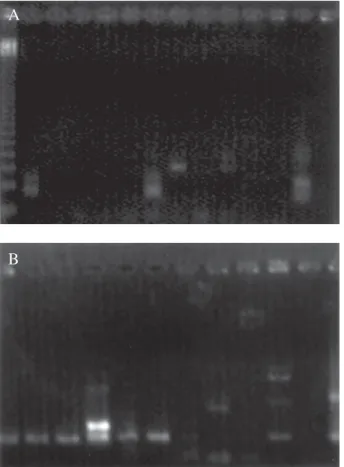 Fig. 2: polymerase chain reaction result. Gel electrophoresis showing EBV amplicons (on the left) and a positive control (on the right - samples of HIV+ patients); M = 123 bp DNA ladder marker; A: two positive samples of healthy individuals; B: seven posit
