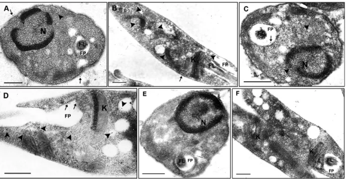 Fig. 3: electron micrographs showing subcellular localization of KMP-11 in Leishmania (Leishmania) amazonensis promastigotes and amas- amas-tigotes  using  an  anti-KMP-11  monoclonal  antibody  and  a  colloidal  gold-conjugated  secondary  antibody