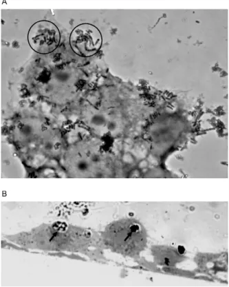 Fig. 1: light micrographs illustrating the aggregative (AA)-like adher- adher-ence pattern to human epithelial (HEp-2) cells (3 h) of  Corynebacteri-um pseudodiphtheriticCorynebacteri-um (HHC1507 strain)
