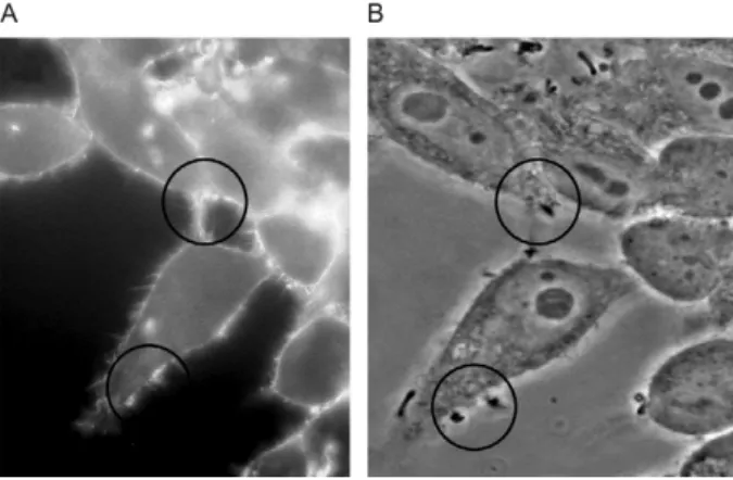 Fig.  2:  fluorescence  (A)  and  phase-contrast  microscopy  (B)  showing  positive  fluorescent  actin  staining  (FAS)  test  of  Corynebacterium  pseudodiphtheriticum