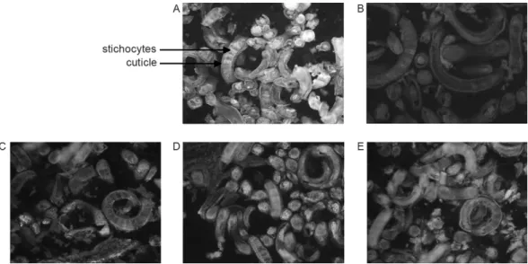 Fig.  1:  human  autoantibodies  cross  react  with  Trichinella  spiralis:  indirect  immunofluorescence  (IIF)  staining