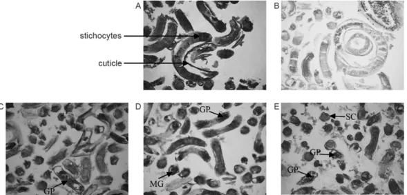 Fig.  2:  human  autoantibodies  cross  react  with Trichinella  spiralis.  Immunohistochemical  staining  using  anti-Ig-HRPO  as  a  secondary  anti- body