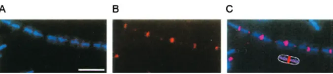 Fig. 3: negative staining showing the assembly in vitro of FtsZ which  appears in spiral strands (A, B) or as rings (C)
