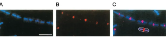 Fig. 3: negative staining showing the assembly in vitro of FtsZ which  appears in spiral strands (A, B) or as rings (C)