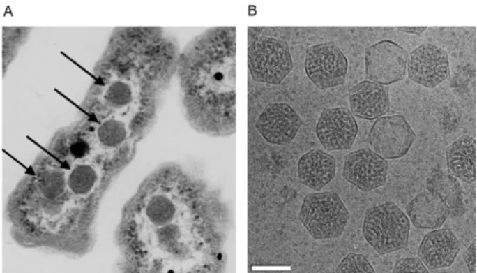 Fig. 6: transmission electron microscopy of a thin section (A) of Ha- Ha-lothiobacillus  neapolitanus  showing  carboxysomes  inside  the  cell  (arrows) and a negative staining of isolated carboxysomes (B)