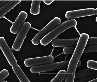 Fig. 11: scanning electron microscopy showing the presence of nano- nano-tubes connecting bacteria