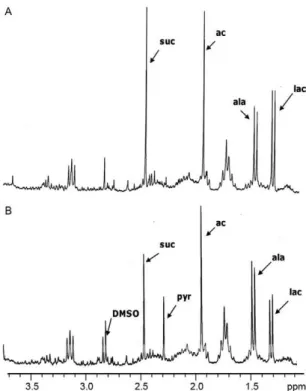 Fig. 3:  1 H nuclear magnetic resonance spectroscopy spectra of promas- promas-tigote forms of Leishmania infantum