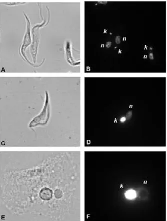 Fig. 1: images of the main patterns of kinetoplast DNA arrangement. 