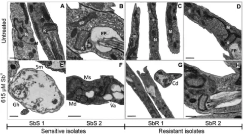 Fig. 1: ultrastructural images obtained from transmission electron microscopy (TEM) in different conditions