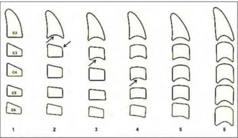 Figura 10 – Seis estágios de maturação das vértebras cervicais de acordo                      com Hassel e Farman  13 , 1995 