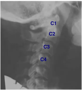 Figura 12 - Localização das vértebras cervicais de humanos 