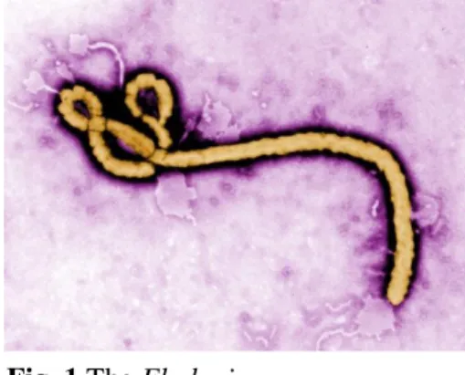 Fig. 1 The Ebolavirus. 