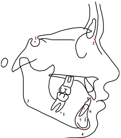 Figura 6  - Pontos cefalométricos utilizados na telerradiografia em norma  lateral e representação da posição dos implantes
