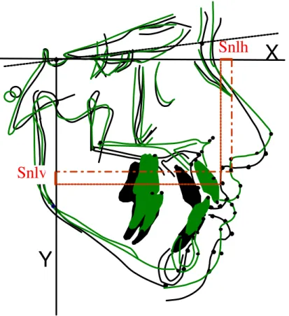 FIGURA 6  - Ilustração das movimentações horizontal e  vertical do ponto Snl. 